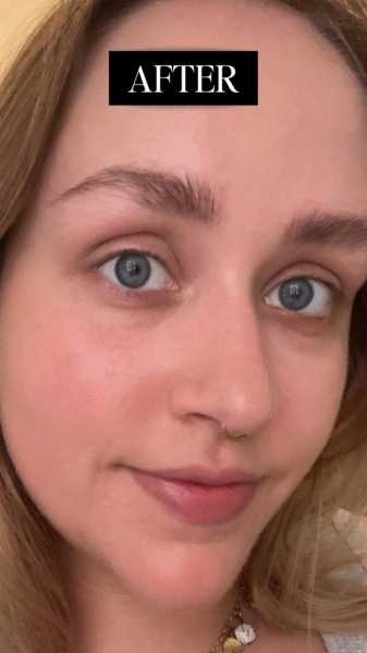 I’ve Tried Every Product for My Dark Under Eyes—This One Finally Worked